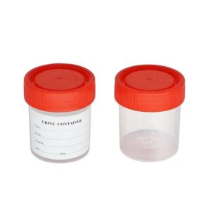 China products/suppliers. Disposable Medical PP 120ml Sterile Urine Specimen Cup Urine Container with Label